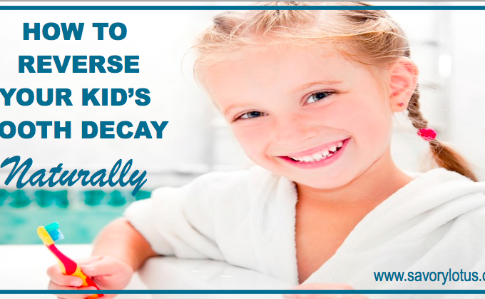How to Reverse Your Kid's Tooth Decay Naturally: savorylotus.com